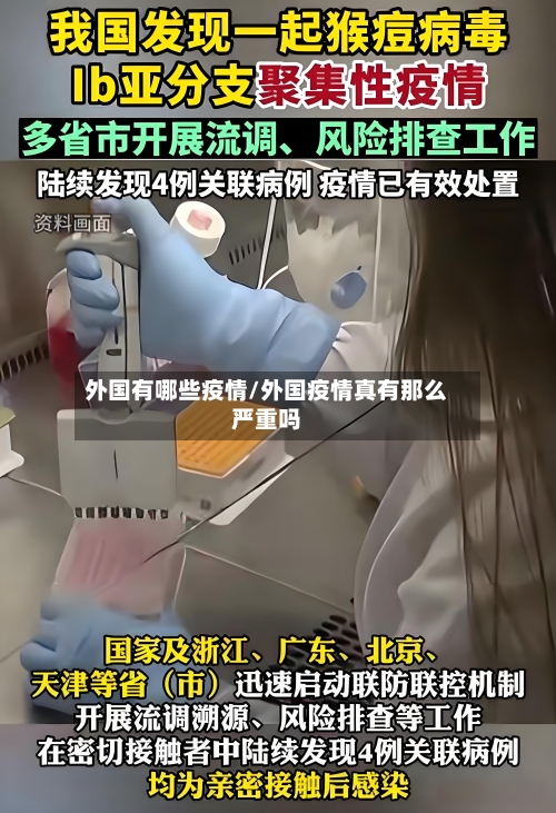 外国有哪些疫情/外国疫情真有那么严重吗