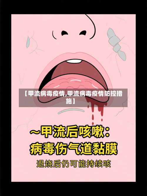 【甲流病毒疫情,甲流病毒疫情防控措施】-第2张图片