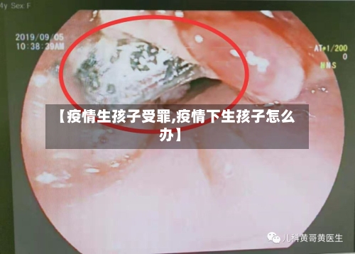 【疫情生孩子受罪,疫情下生孩子怎么办】-第2张图片