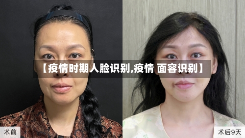 【疫情时期人脸识别,疫情 面容识别】-第3张图片