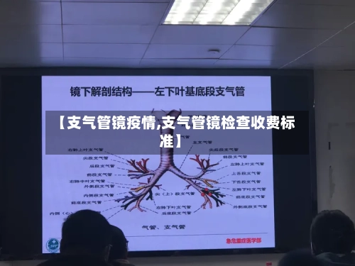 【支气管镜疫情,支气管镜检查收费标准】-第3张图片